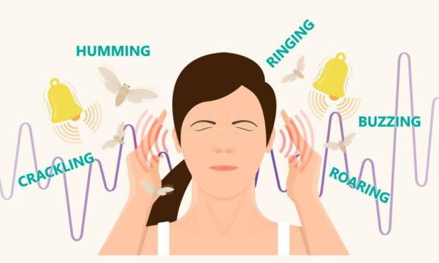 Ringing in your ears is a sign of tinnitus.