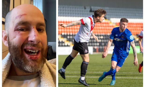 Cove Rangers fan Michael Anderson was assaulted after his team's game at Airdrie. Photo: Michael Anderson/Dave Cowe