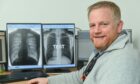 Dr Struan Wilkie, head of radiology IT for NHS Grampian, looks at the X-ray software. Picture by Jason Hedges