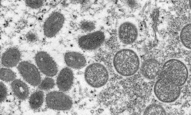 Monkeypox cells.