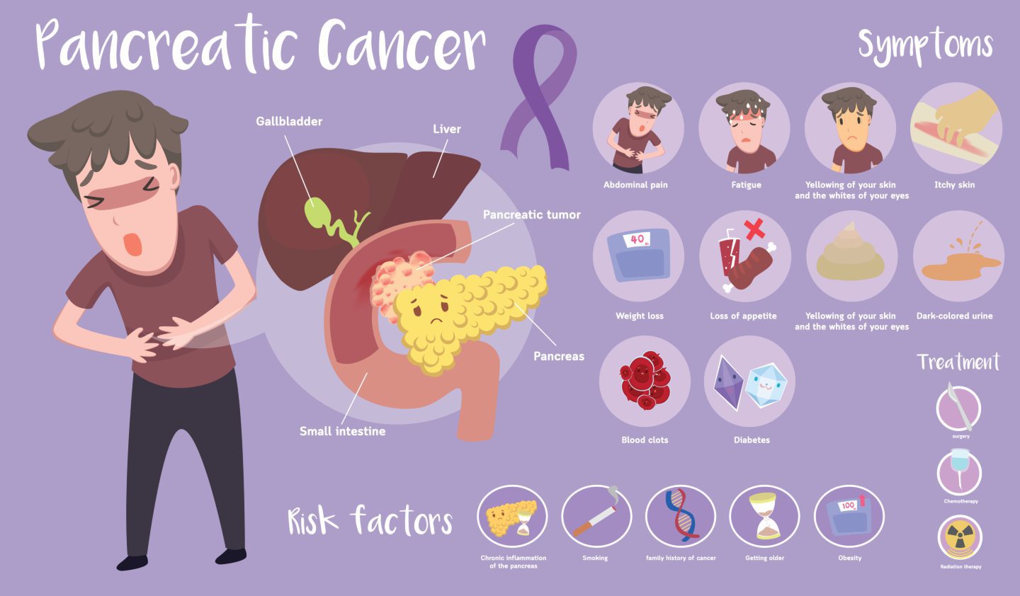 Typical symptoms of pancreatic cancer.