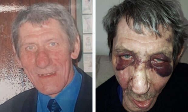 Frail cancer victim beaten and stabbed during horrific assault and robbery