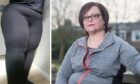 Donna Adams suffered dislocated knees and had to quit her job, but was just told she needed to lose weight.