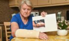Winnie Miller with a photograph showing her injuries. Photo: Jason Hedges/DC Thomson.