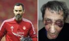 Aberdeen Football Club captain Joe Lewis and robbery victim James Clunes who was badly beaten.