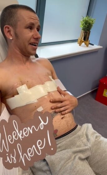 Lee says "I can't believe how flat it all looks" after the dressings are removed post-surgery