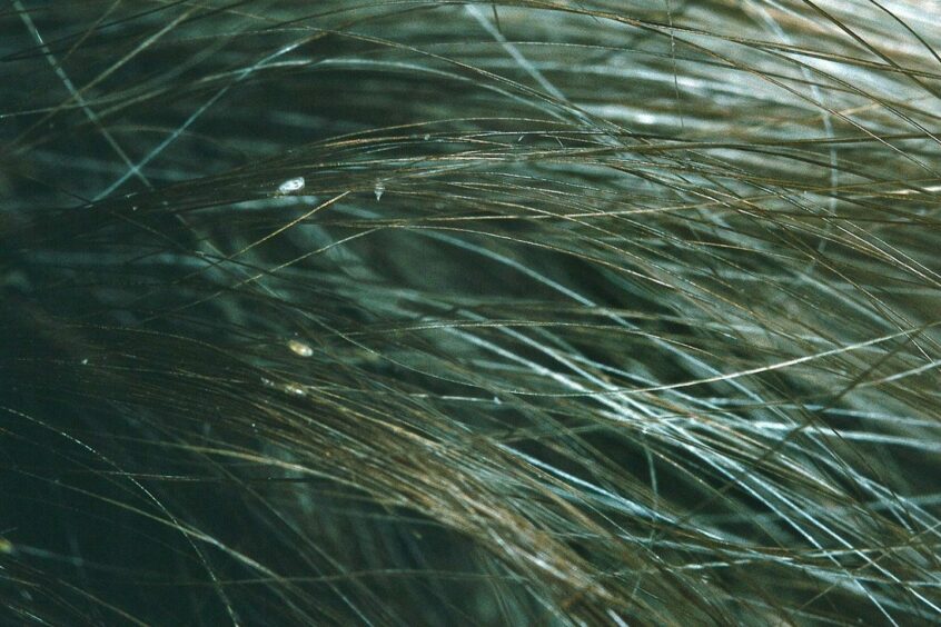 A close up of head lice on brown hair