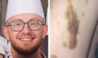 Chef Jonathan Wiggins and one of the photos of alleged injuries seen by the court