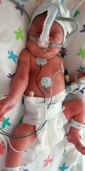 Caiti spent four weeks in the neonatal unit in Aberdeen.