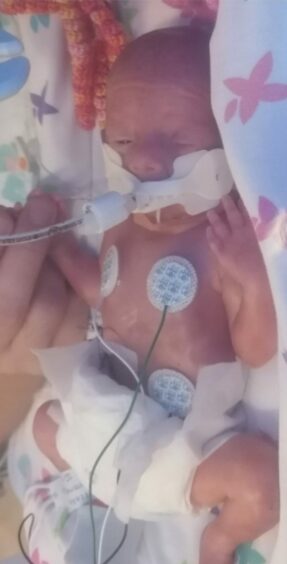 Baby Evie spent 12 weeks in the neonatal unit in Aberdeen