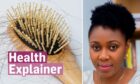 Brush full of hair next to a photo of Aberdeen nutritionist Peace Odu and the 'Health Explainer' logo