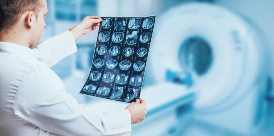 Doctor examines MRI picture.
