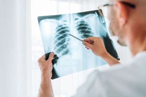 An NHS Grampian area medical practice failed to diagnose the condition. Image: Shutterstock.