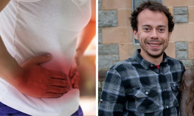 Calum MacColl has spoken of his experiences with Crohn's symptoms. Images: Shutterstock/ The Write Image
