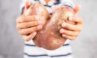 Have a heart: The UK Government is being urged to support a fund that helps farmers turn surplus produce - like wonky vegetables - into meals for people in need. Image: Shutterstock.
