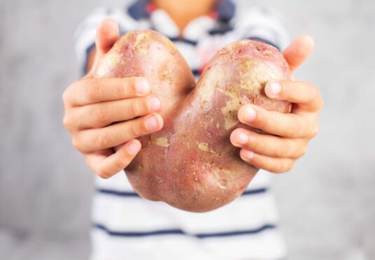 Have a heart: The UK Government is being urged to support a fund that helps farmers turn surplus produce - like wonky vegetables - into meals for people in need. Image: Shutterstock.