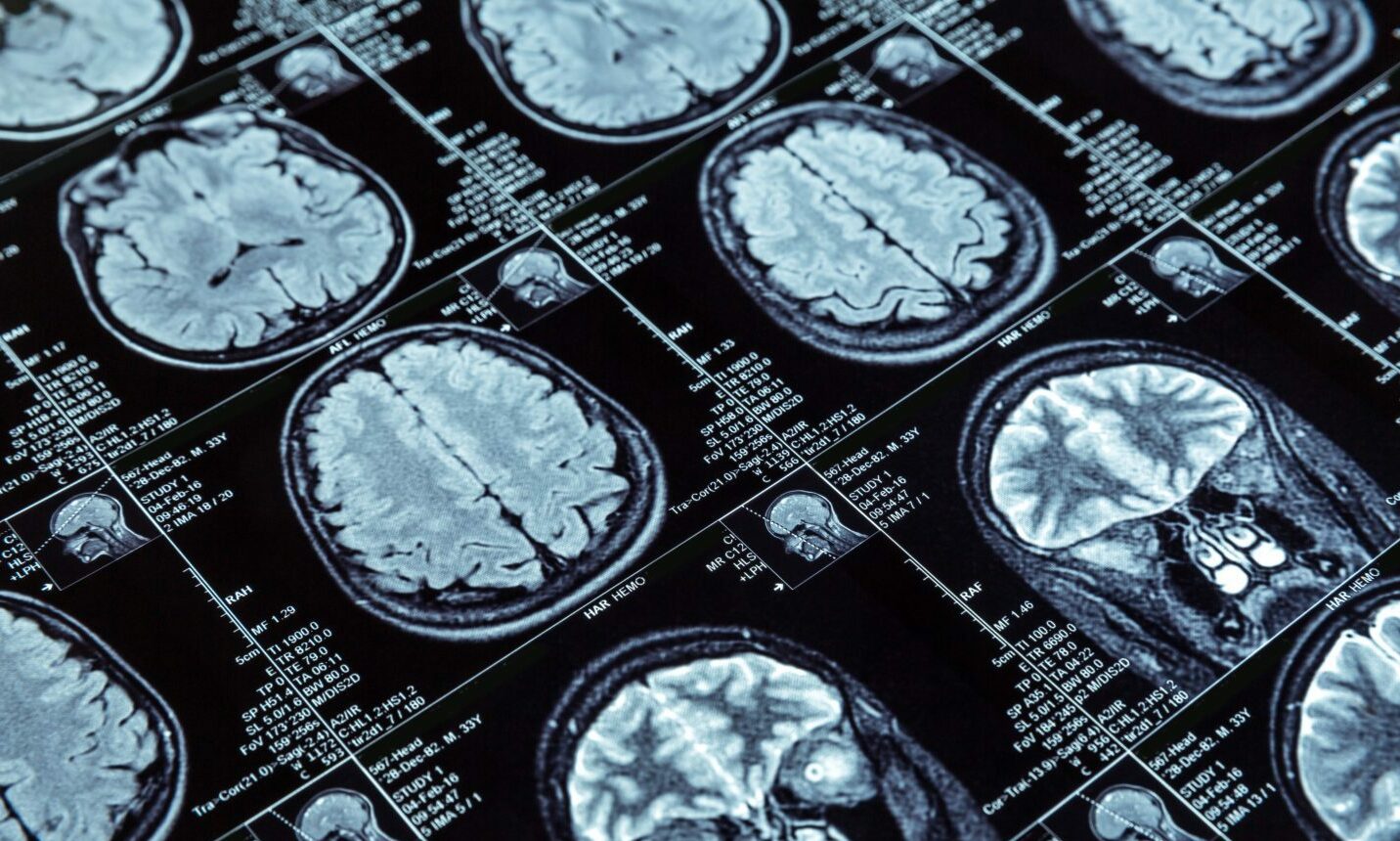 Billy was given a brain scan as part of his diagnosis. Image: Shutterstock / Nomad_Soul