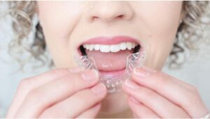 Dental patient with clear brace