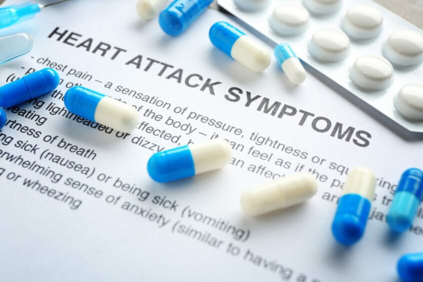 Typical heart attack symptoms not always experienced during a silent heart attack.