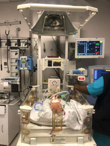 Baby Callen in intensive care at a hospital, which prompted his grandmother to start a fundraiser for his treatment.