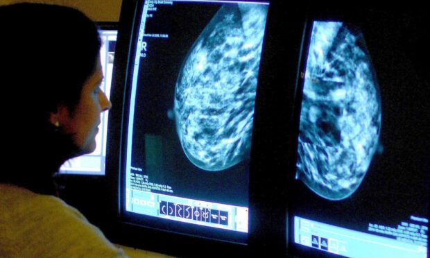 A consultant analysing a mammogram to detect breast cancer.