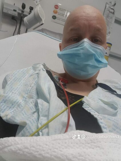 Amanda after a round of chemotherapy in Dyce.