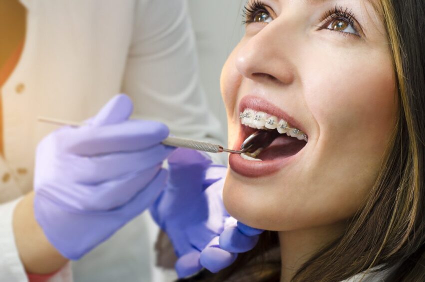 A woman with braces on her teeth has her mouth examined by a dentist.