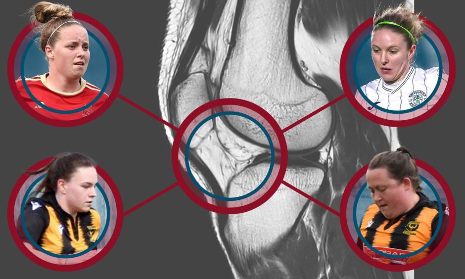 Image shows graphic of an x-ray of an anterior cruciate ligament (ACL) alongside four players - Laura Holden, Rachael Boyle, Kaylah Cruickshank and Laura Parsley - who have suffered an injury to their knee.