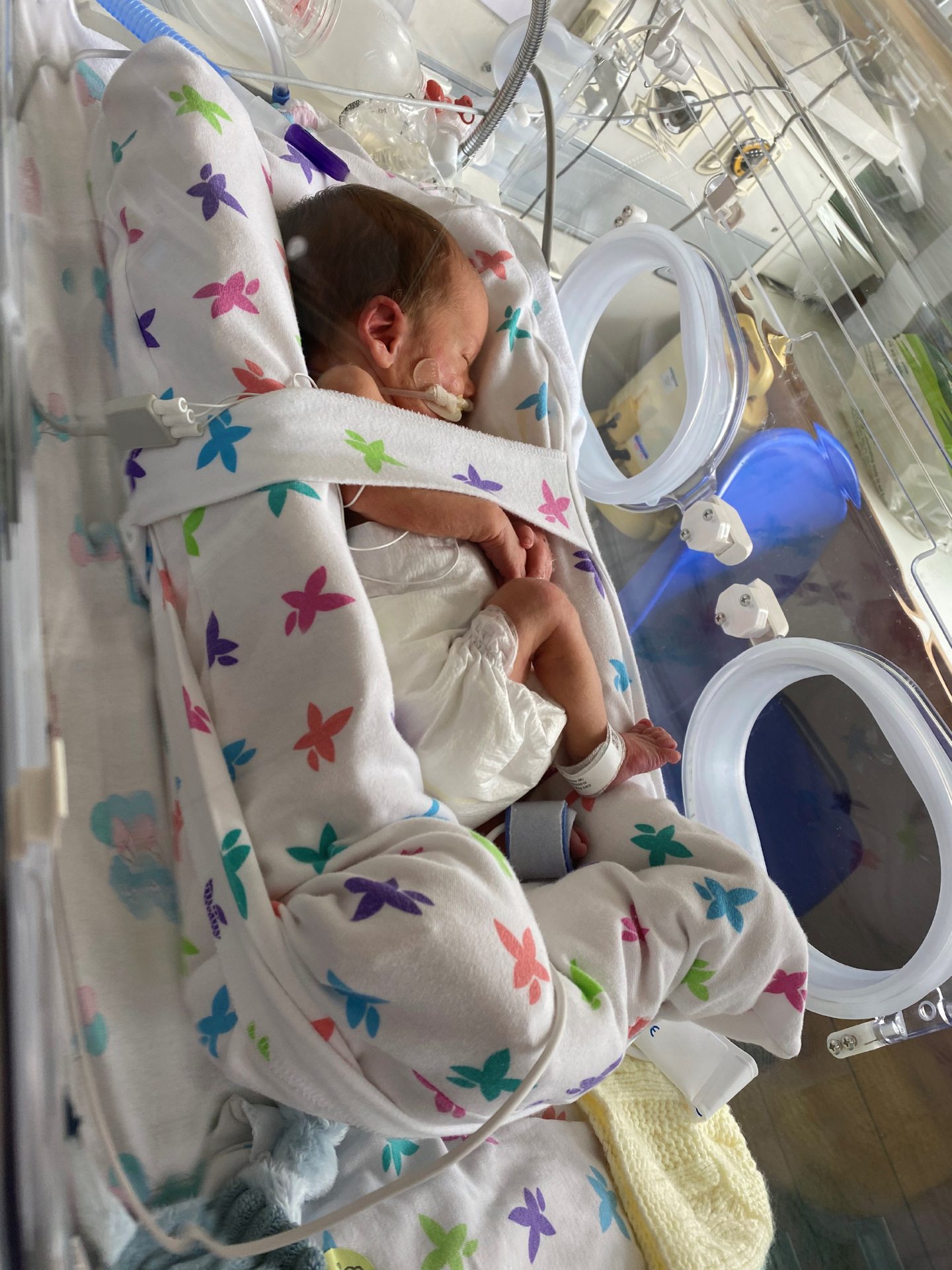 Brody pictured in the neonatal unit at Aberdeen Maternity Hospital. 