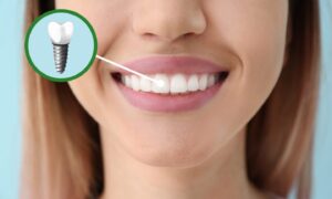 Regain the confidence in your smile with Dental Implant Centre in Aberdeen.
