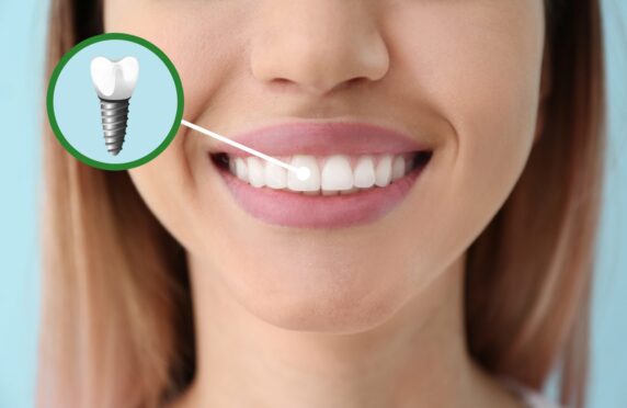 Regain the confidence in your smile with Dental Implant Centre in Aberdeen.