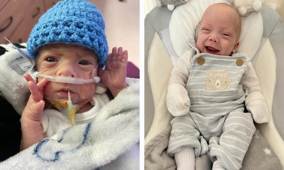Two photos side-by-side of Logan Park when he was first born in a blue hat and him smiling months later lying down.
