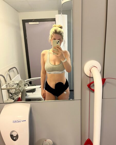 Samantha takes a mirror selfie of her stoma bag while in a hospital toilet