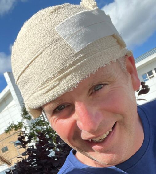 Glenn Campbell, bandaged up.