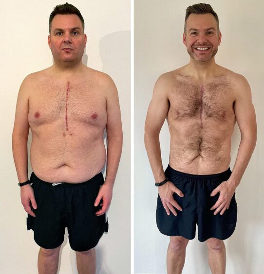 Before and after pics of Stuart after he lost six stone following his stroke.