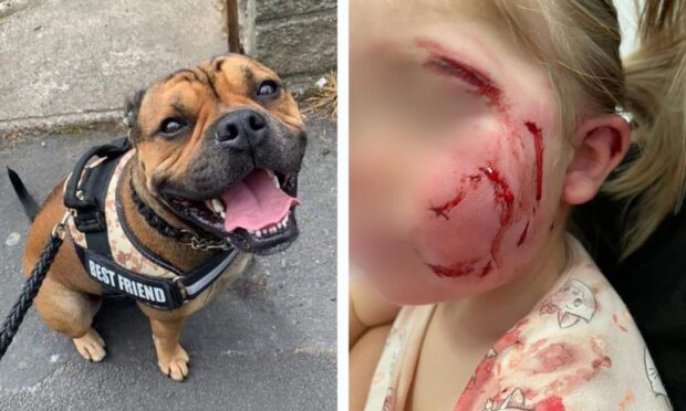 Benji savagely attacked a little girl in Aberdeen.