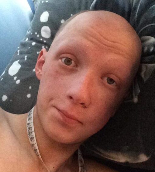 A selfie of Aiden without any hair during his chemo treatment