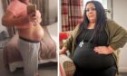 Suzi Winpenny says her hernia has impacted her life and left her too overweight for an operation. Image: Suzi Winpenny/DC Thomson