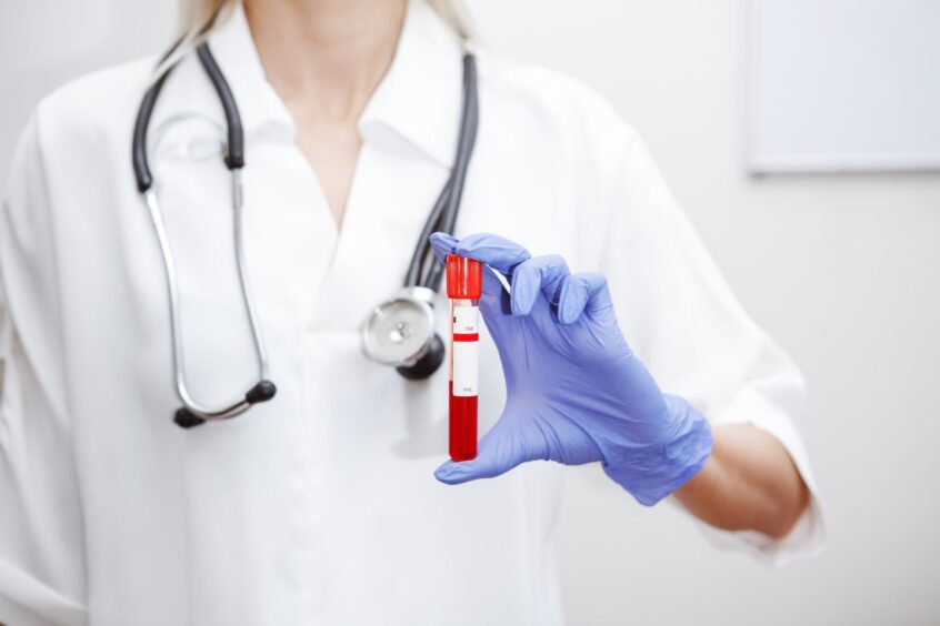 Doctor holding vial of blood.