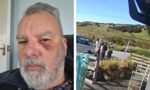 Mr Mahon was left with a black eye following the incident. Image: Supplied.