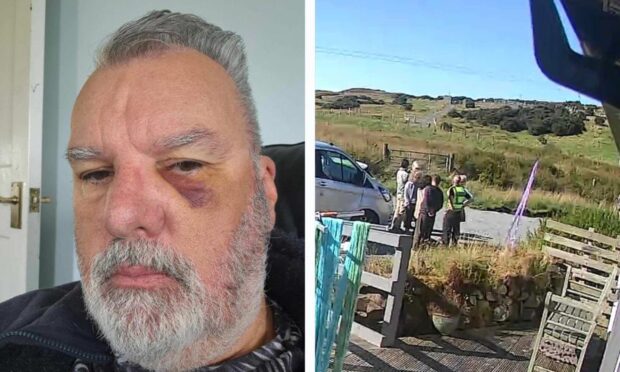 Mr Mahon was left with a black eye following the incident. Image: Supplied.