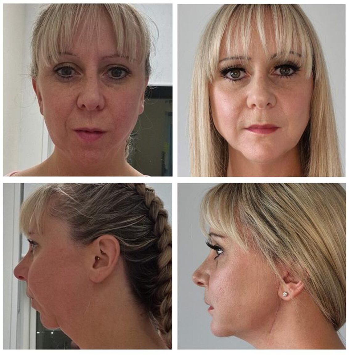 Sauchen woman praises surgeon for lifechanging jaw surgery