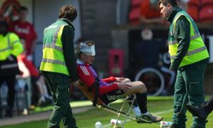 Aberdeen Jack MacKenzie was left with a head wound after the incident at Tannadice. Image: Pete Summers/Shutterstock