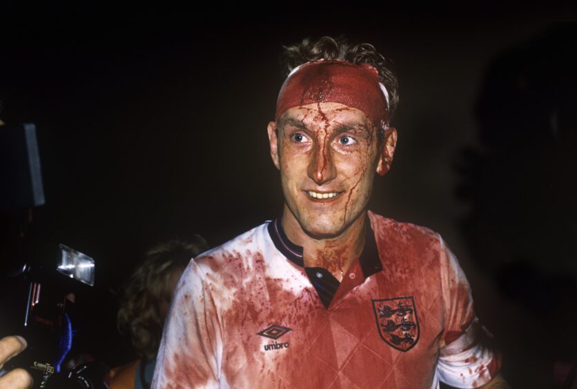 England's Terry Butcher at the end of the match in the Rasunda Stadium, Stockholm, Sweden, covered in blood due to his cut head during a 0-0 World Cup qualifying draw, This is from September 6, 1989.