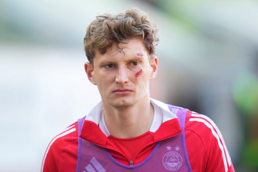 Aberdeen defender Jack MacKenzie was left with facial injuries after being struck by a chair at Tannadice. Image: Shutterstock 