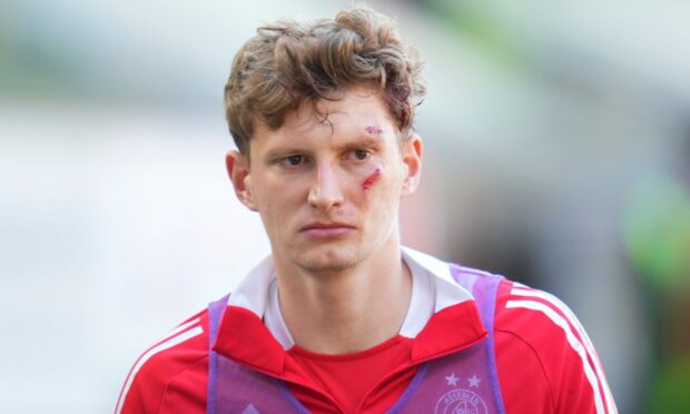 Aberdeen's Jack Mackenzie required stitches after being hit by a chair after the 2-1 loss to Dundee United at Tannadice.