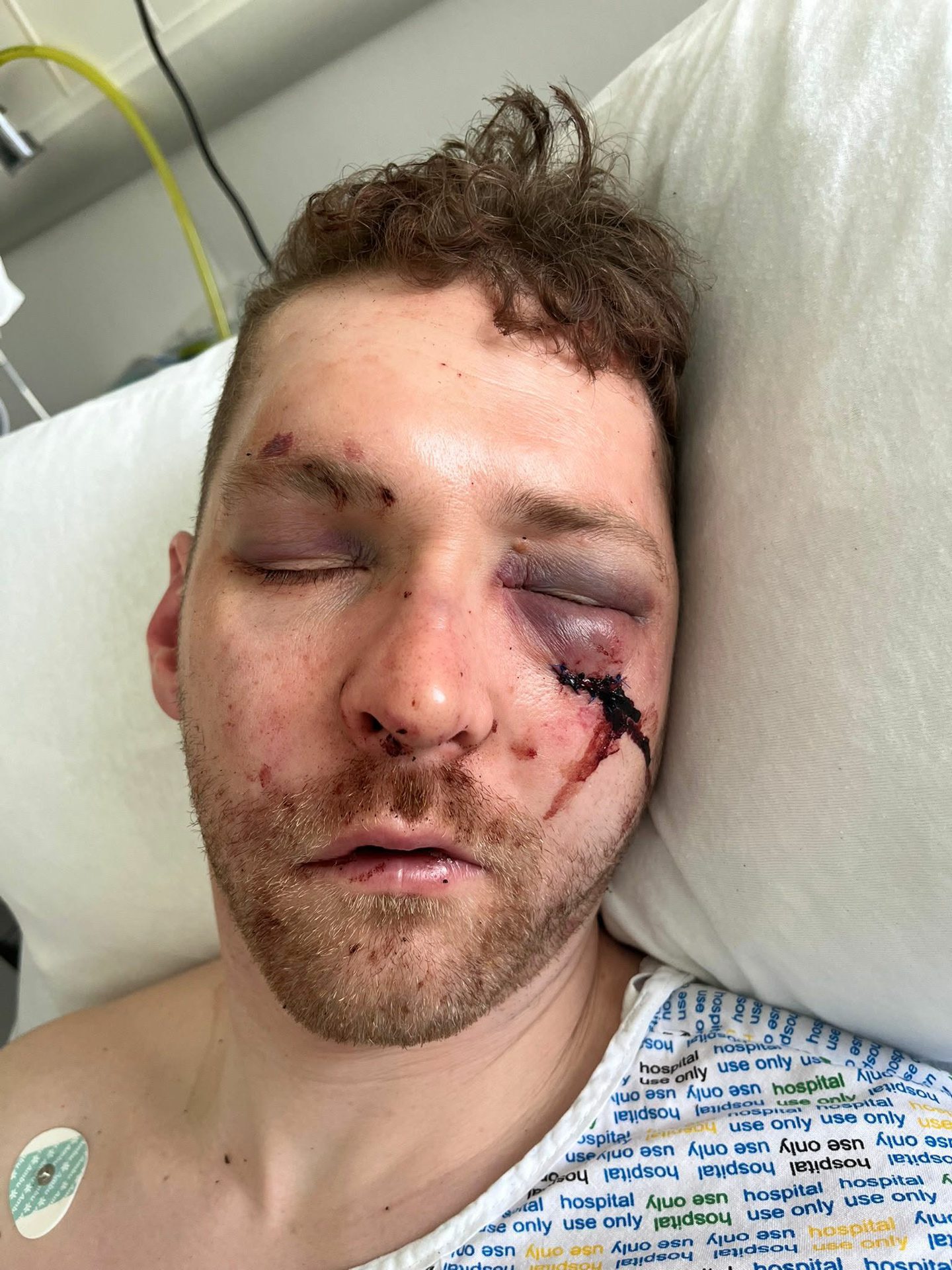 Jail for man after brutal Union Street assault in Aberdeen