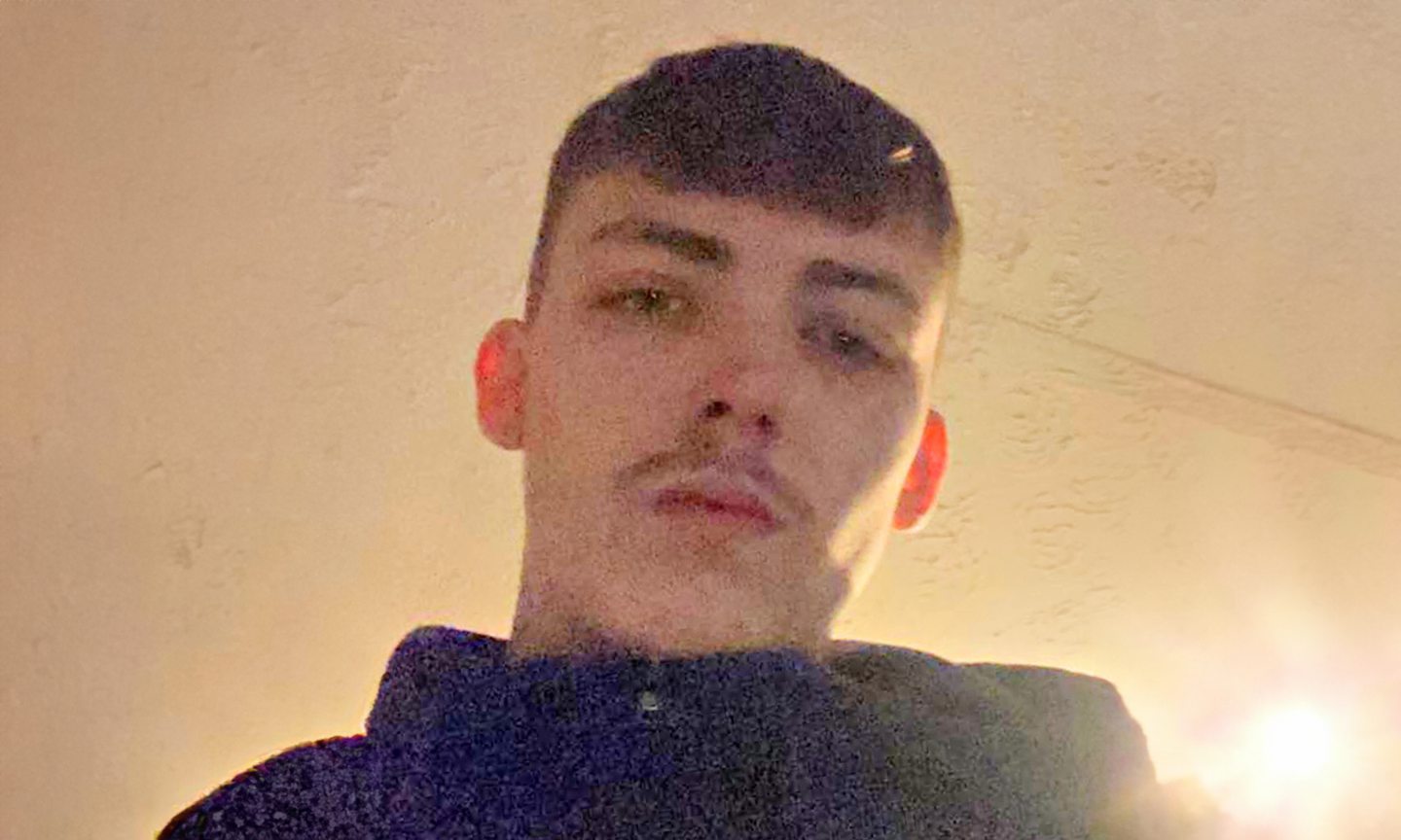 Aberdeen man jailed after he bit off neighbour’s nose during dog noise dispute