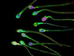 Research found using high-frequency ultrasound waves on sperm can boost their ability to swim (The Journal of Science of Human Sperm/PA)