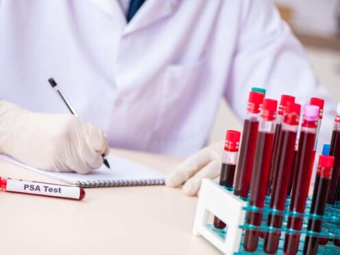 Men aged over 50 years without symptoms are able to request the blood test from their GP (Alamy/PA)
